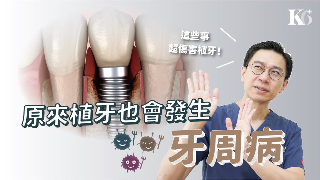 植體周圍炎會導致植牙失敗嗎？如何早期發現？
