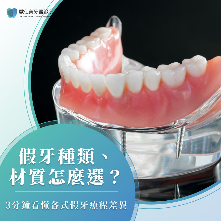 假牙種類、材質怎麼選？3分鐘看懂各式假牙療程差異