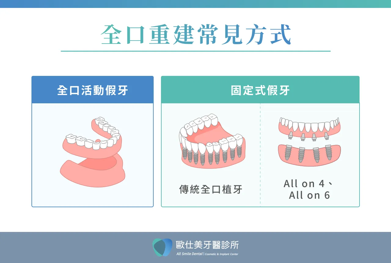 全口重建常見方式