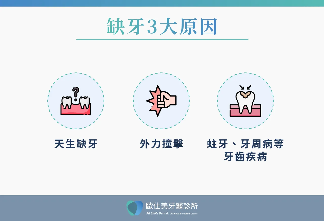 缺牙3大原因