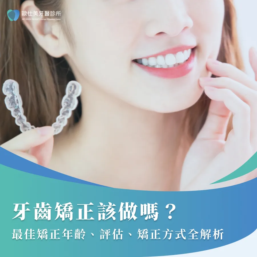 牙齒矯正該做嗎？最佳矯正年齡、評估、矯正方式全解析