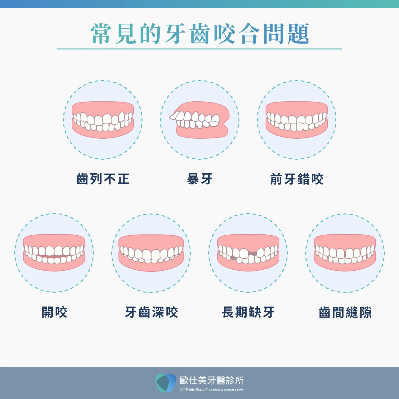 常見咬合不正問題類型