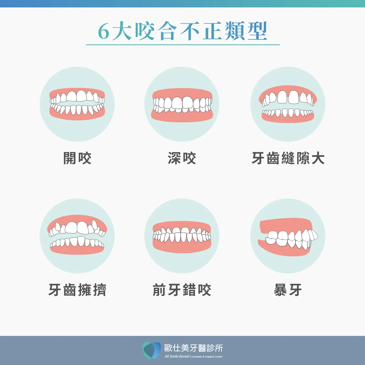 咬合不正6大類型