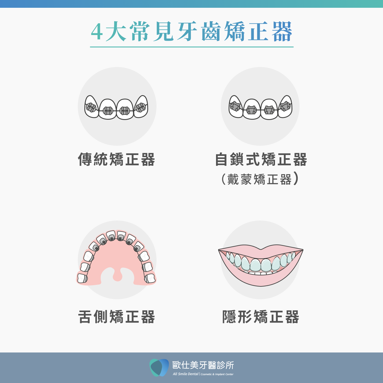 4大常見牙齒矯正器分享