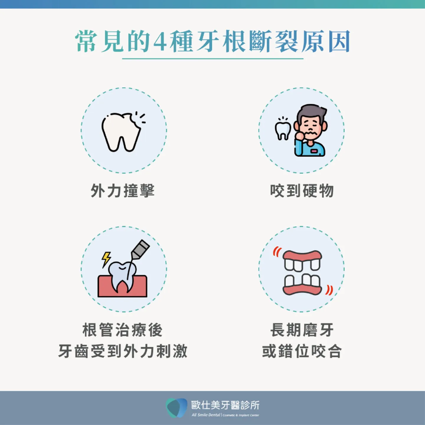 常見的4種牙根斷裂原因
