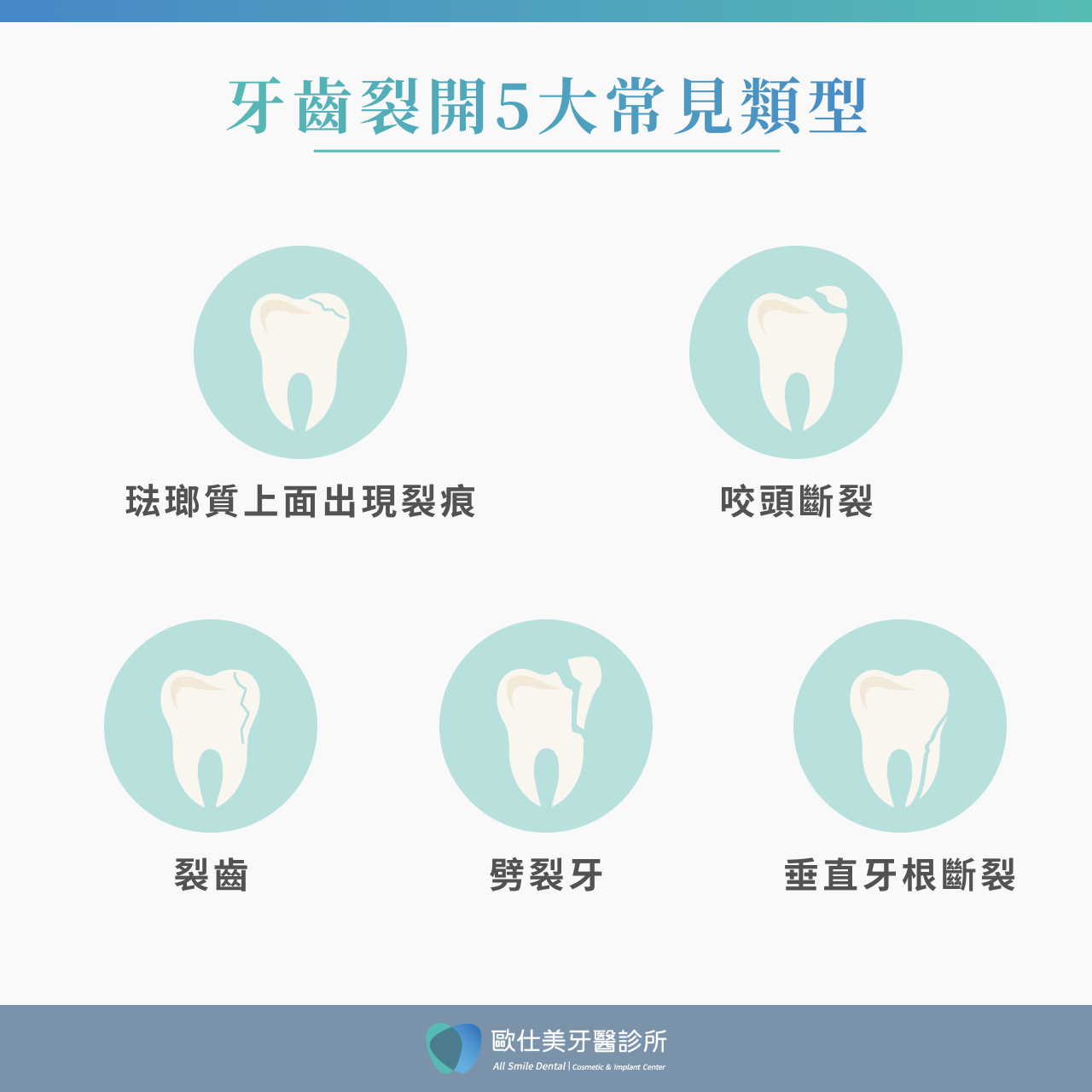 牙齒裂開5大常見類型
