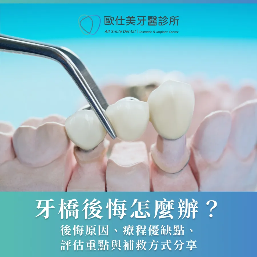 牙橋後悔怎麼辦？後悔原因、療程優缺點、評估重點與補救方式分享