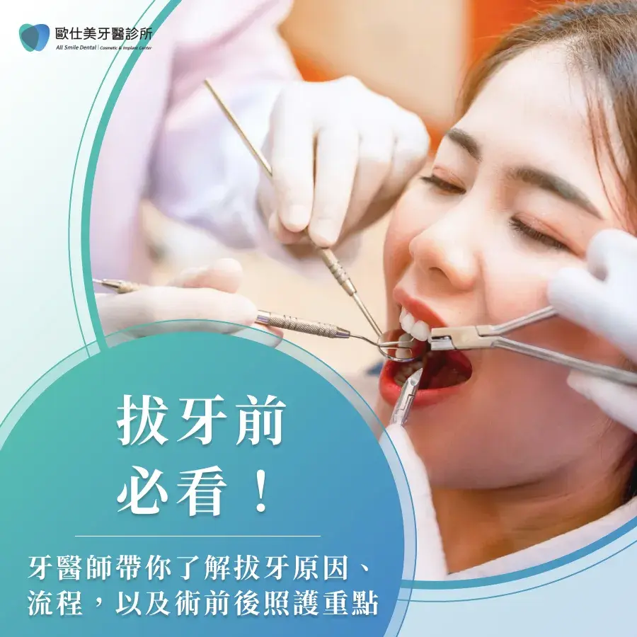 Image3拔牙前必看！牙醫師帶你了解拔牙原因、流程，以及術前後照護重點