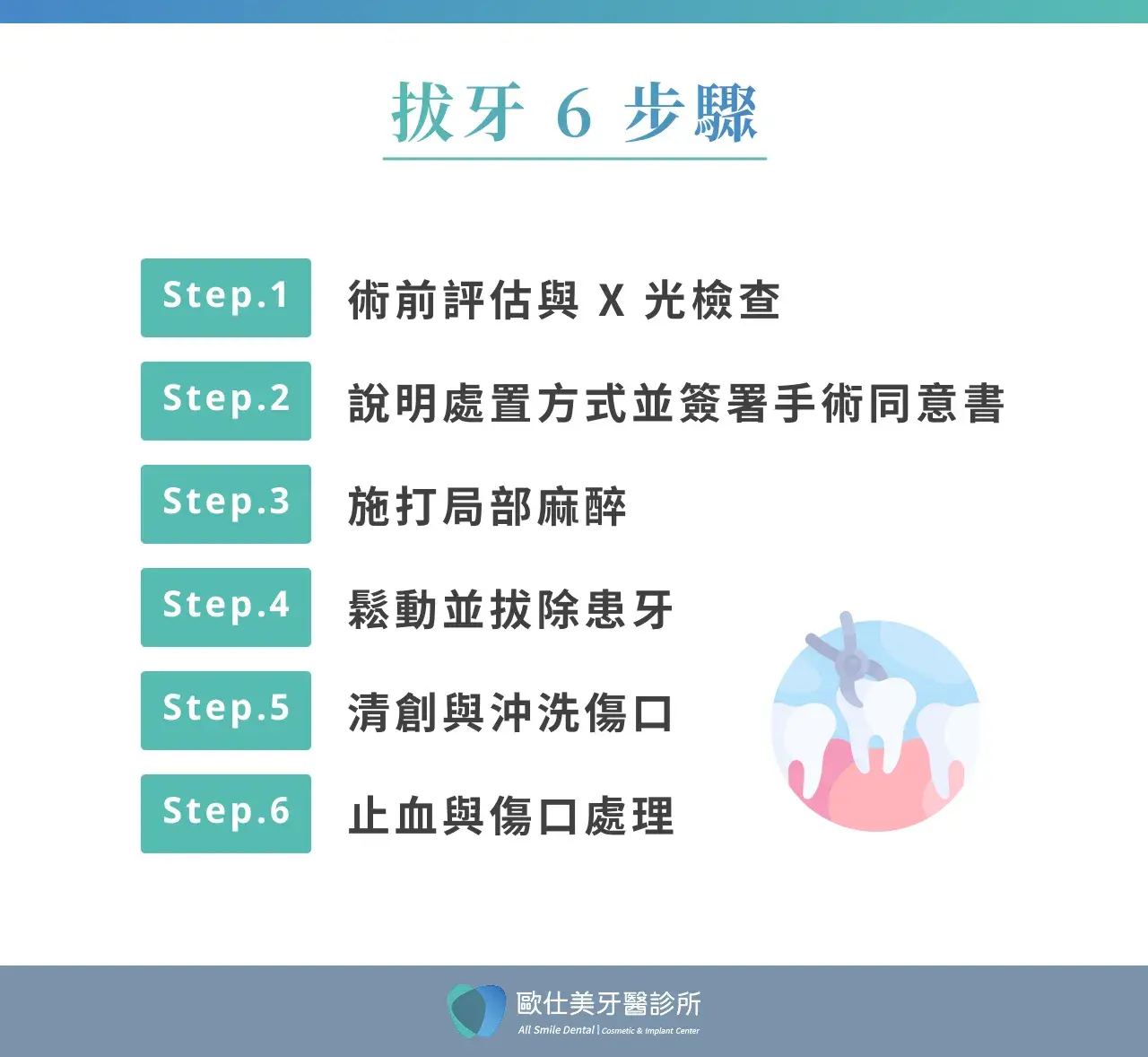 拔牙6 步驟