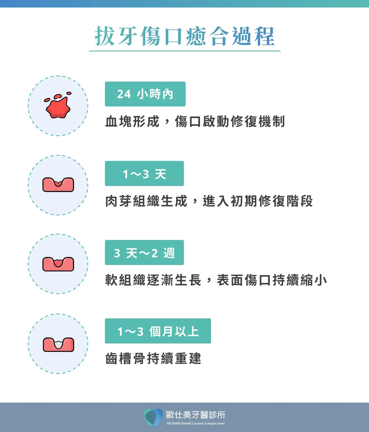 拔牙傷口癒合過程